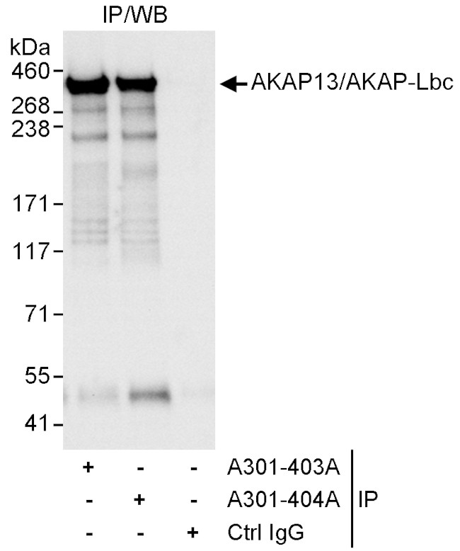 AKAP13/AKAP-Lbc Antibody in Immunoprecipitation (IP)