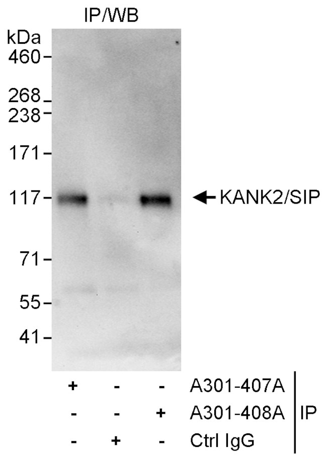 KANK2/SIP Antibody in Immunoprecipitation (IP)