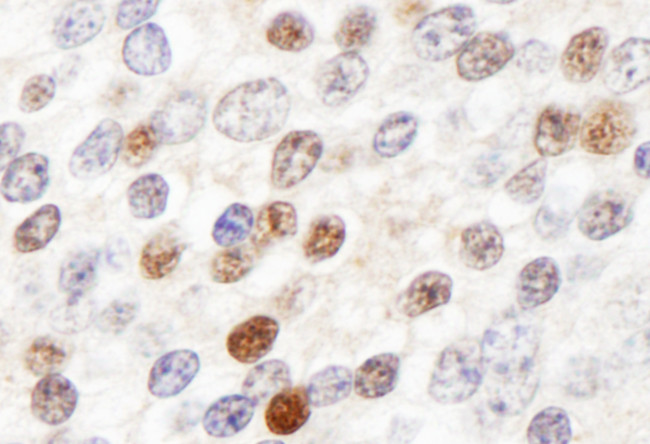 ZHX3 Antibody in Immunohistochemistry (Paraffin) (IHC (P))