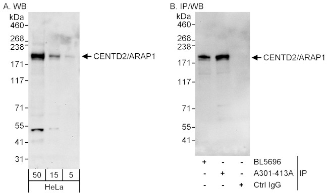 CENTD2/ARAP1 Antibody in Western Blot (WB)