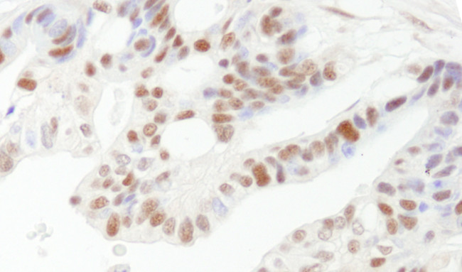 DFF45/DFFA Antibody in Immunohistochemistry (Paraffin) (IHC (P))