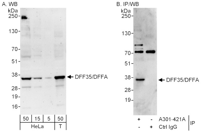 DFF35/DFFA Antibody in Western Blot (WB)