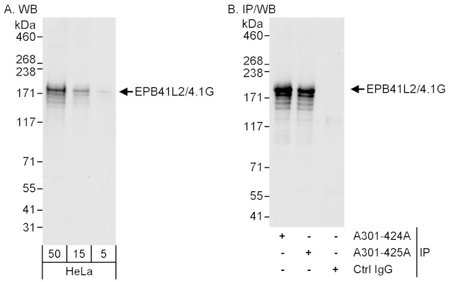 EPB41L2/4.1G Antibody in Western Blot (WB)