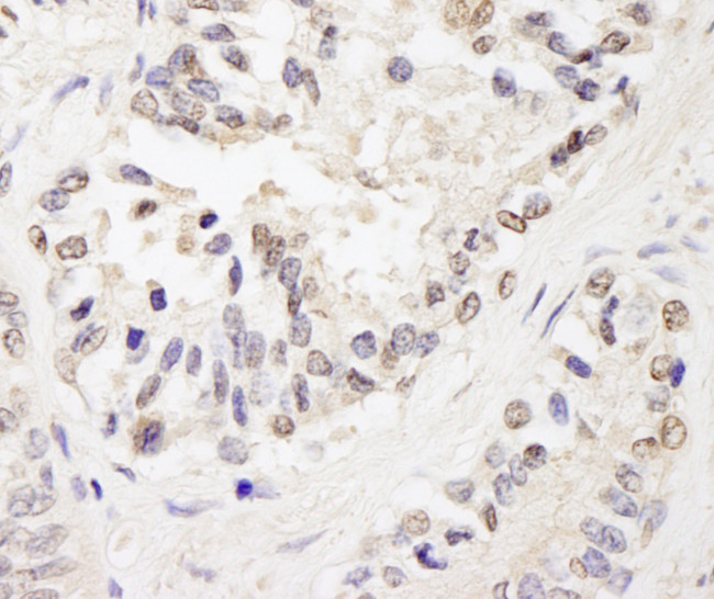 FOG1/ZFPM1 Antibody in Immunohistochemistry (Paraffin) (IHC (P))