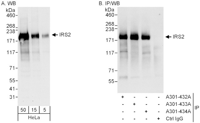 IRS2 Antibody in Western Blot (WB)