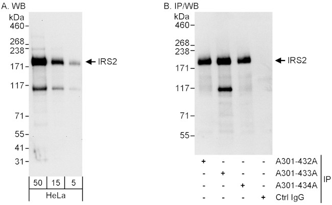 IRS2 Antibody in Western Blot (WB)