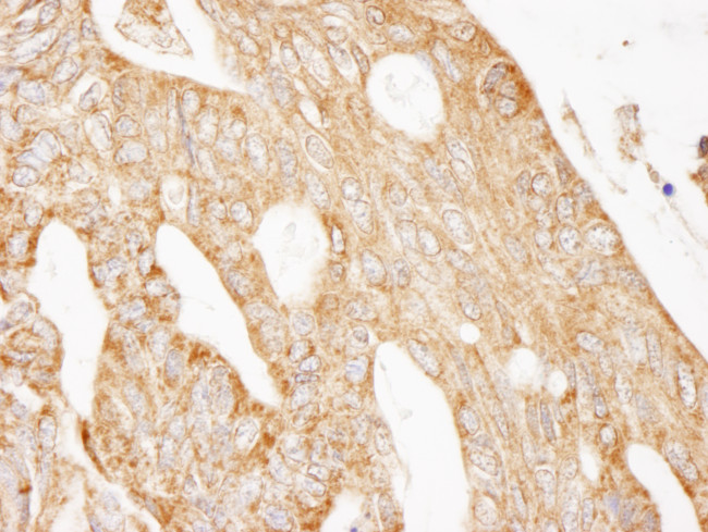 IRS2 Antibody in Immunohistochemistry (Paraffin) (IHC (P))