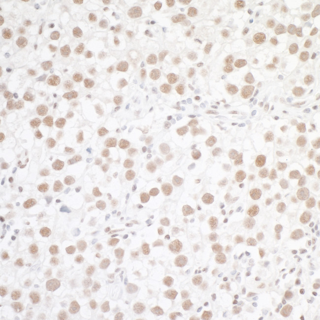 WTAP Antibody in Immunohistochemistry (Paraffin) (IHC (P))