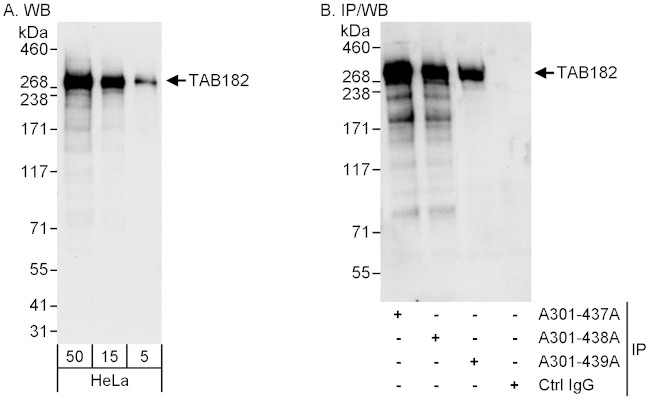 TAB182 Antibody in Western Blot (WB)