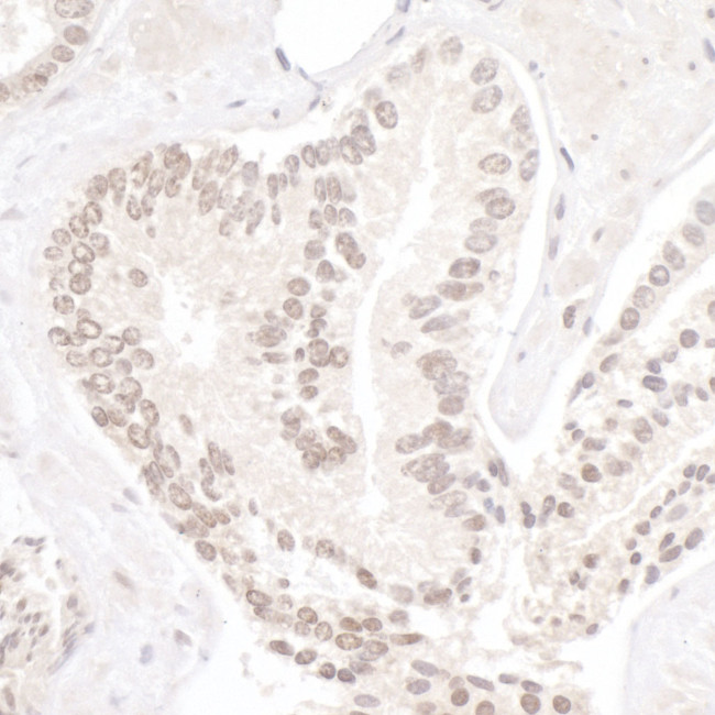 NP95/UHRF1 Antibody in Immunohistochemistry (Paraffin) (IHC (P))