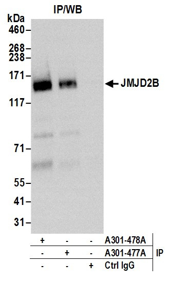 JMJD2B Antibody in Immunoprecipitation (IP)