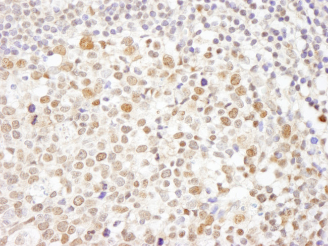 Caf1p150 Antibody in Immunohistochemistry (Paraffin) (IHC (P))