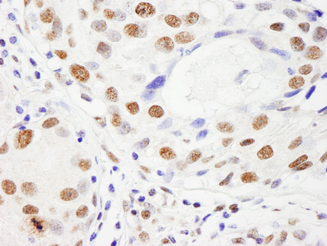 NUMA Antibody in Immunohistochemistry (Paraffin) (IHC (P))