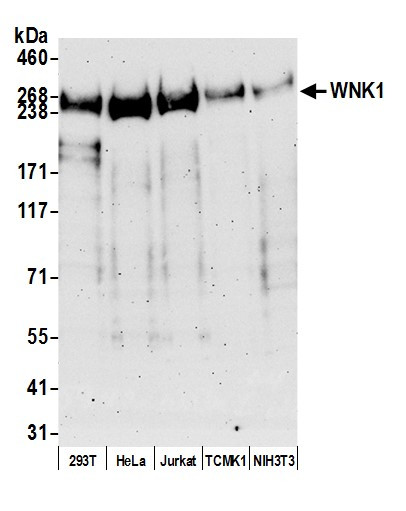 WNK1 Antibody in Western Blot (WB)