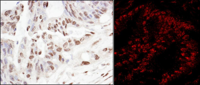 SART3/TIP110 Antibody in Immunohistochemistry (Paraffin) (IHC (P))