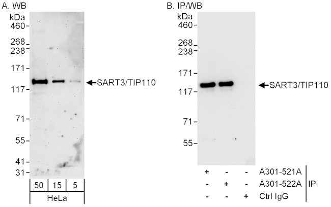 SART3/TIP110 Antibody in Western Blot (WB)