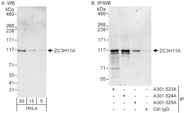 ZC3H11A Antibody in Western Blot (WB)