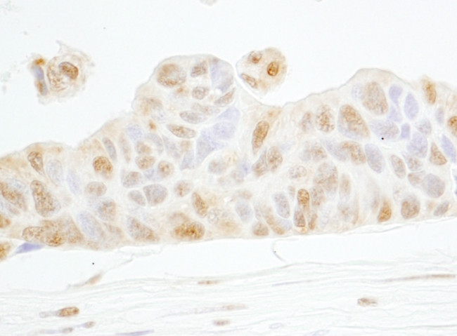 Cyclin E1 Antibody in Immunohistochemistry (Paraffin) (IHC (P))