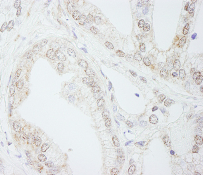 METTL3/MT-A70 Antibody in Immunohistochemistry (Paraffin) (IHC (P))