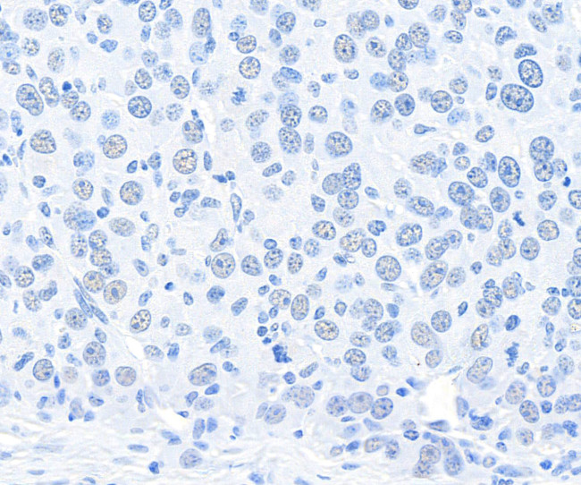 CPSF160 Antibody in Immunohistochemistry (Paraffin) (IHC (P))