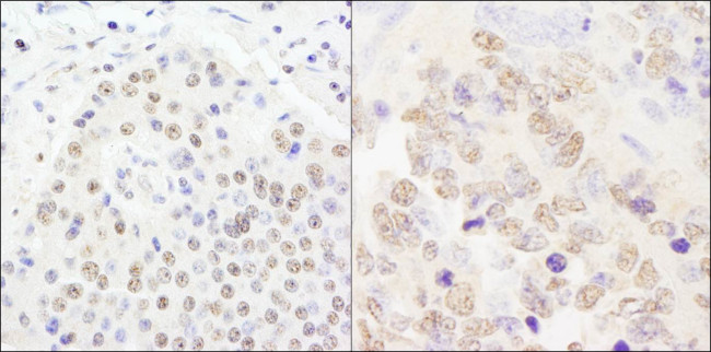 CPSF100 Antibody in Immunohistochemistry (Paraffin) (IHC (P))