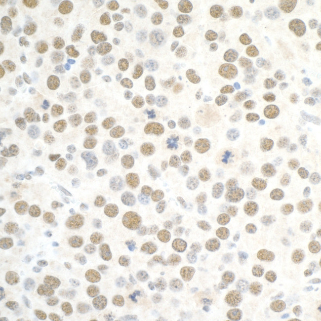 PBRM1 Antibody in Immunohistochemistry (Paraffin) (IHC (P))