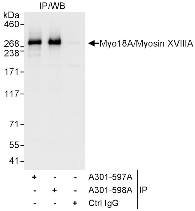 Myo18A/Myosin XVIIIA Antibody in Immunoprecipitation (IP)