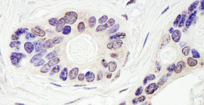 TDP1 Antibody in Immunohistochemistry (Paraffin) (IHC (P))