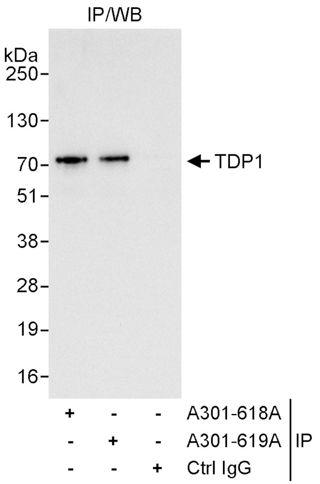 TDP1 Antibody in Immunoprecipitation (IP)