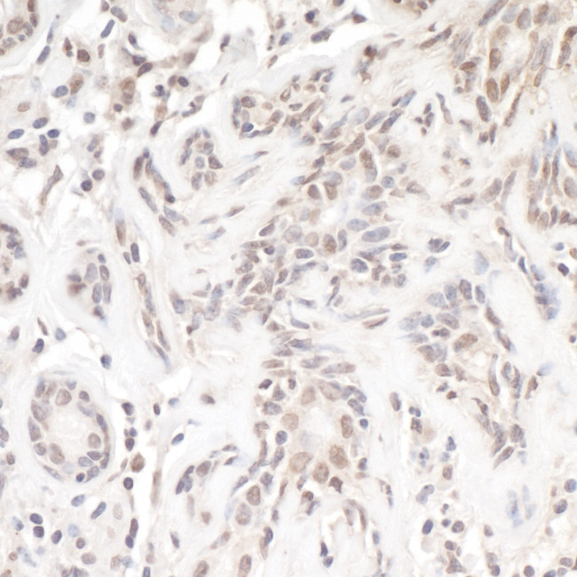 TReP-132/TRERF1 Antibody in Immunohistochemistry (Paraffin) (IHC (P))