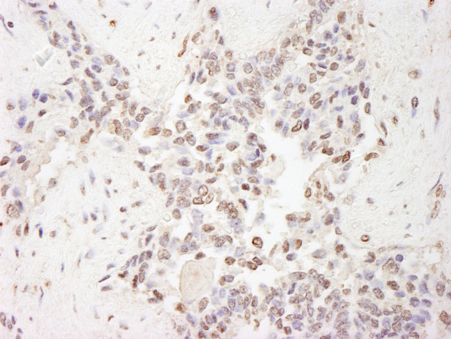 MBD2 Antibody in Immunohistochemistry (Paraffin) (IHC (P))