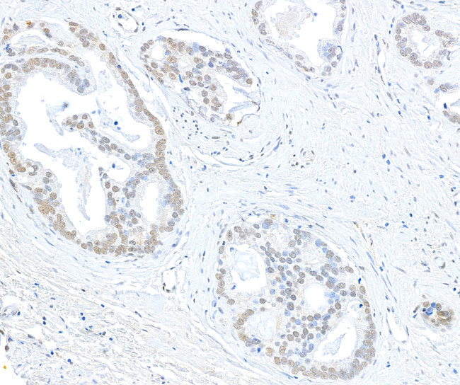 EHMT1 Antibody in Immunohistochemistry (Paraffin) (IHC (P))