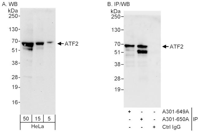 ATF2 Antibody in Western Blot (WB)