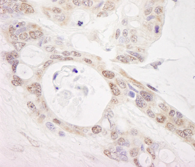 PUS1 Antibody in Immunohistochemistry (Paraffin) (IHC (P))