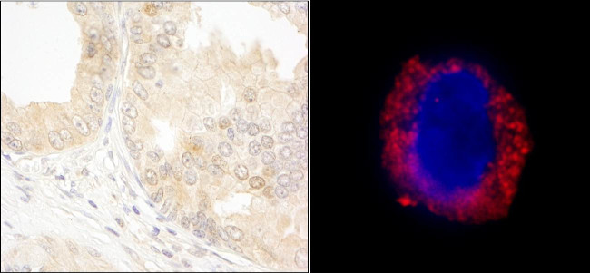 cAbl Antibody in Immunohistochemistry (Paraffin) (IHC (P))