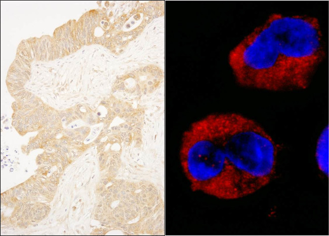 cAbl Antibody in Immunohistochemistry (Paraffin) (IHC (P))