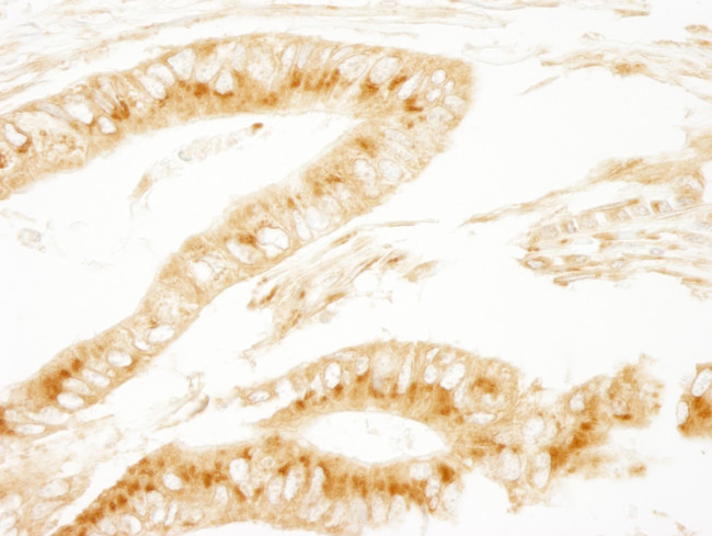 PRKAR2A/PKA-RIIalpha Antibody in Immunohistochemistry (Paraffin) (IHC (P))