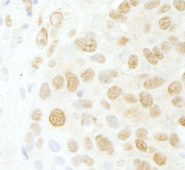 CDC5L Antibody in Immunohistochemistry (Paraffin) (IHC (P))