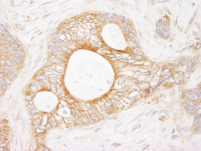 eEF2 Kinase Antibody in Immunohistochemistry (Paraffin) (IHC (P))