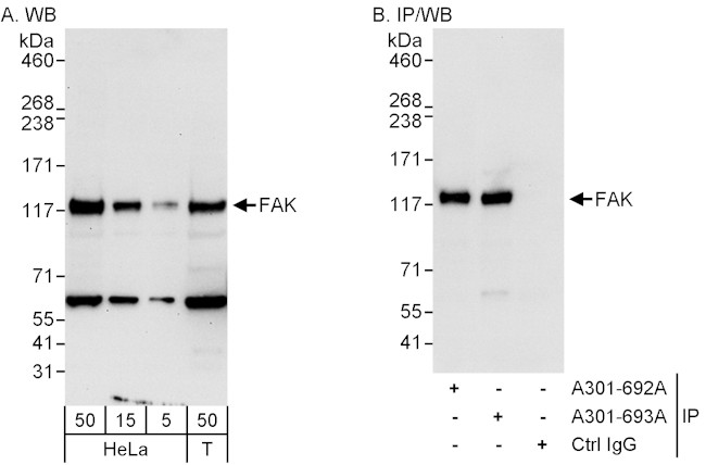 FAK Antibody in Western Blot (WB)