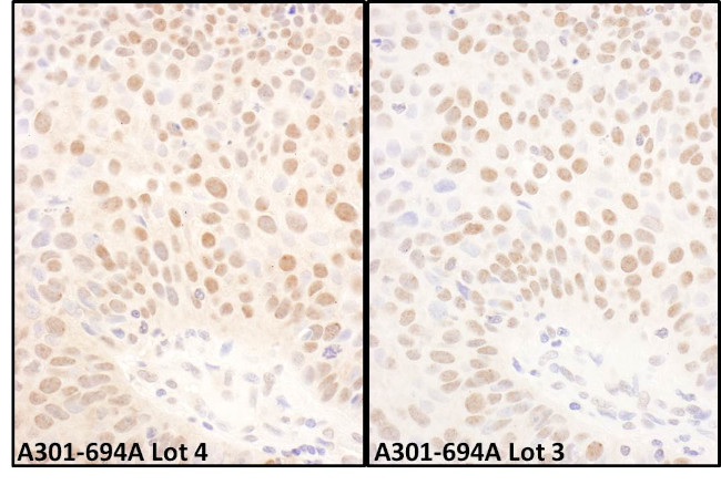 BMI1 Antibody in Immunohistochemistry (Paraffin) (IHC (P))