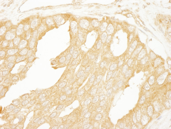 BRAF Antibody in Immunohistochemistry (Paraffin) (IHC (P))