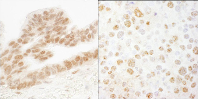 ERF Antibody in Immunohistochemistry (Paraffin) (IHC (P))