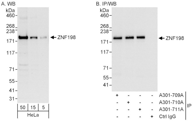 ZNF198 Antibody in Western Blot (WB)