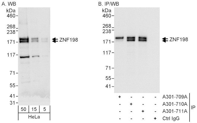 ZNF198 Antibody in Western Blot (WB)