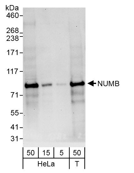 NUMB Antibody in Western Blot (WB)