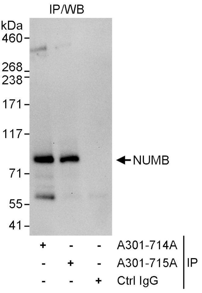 NUMB Antibody in Immunoprecipitation (IP)