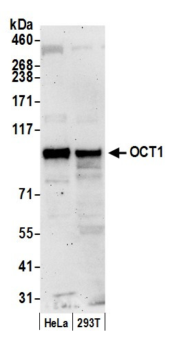 OCT1 Antibody in Western Blot (WB)