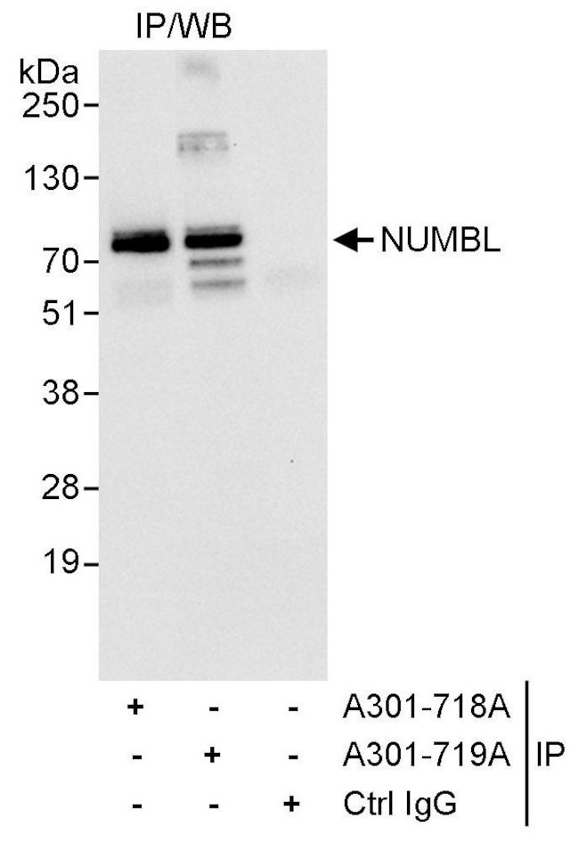 NUMBL Antibody in Immunoprecipitation (IP)