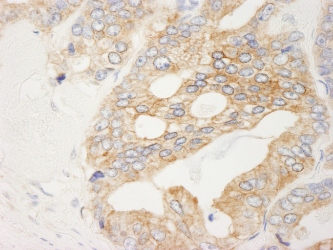 Filamin B Antibody in Immunohistochemistry (Paraffin) (IHC (P))